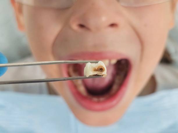 Best Emergency Dentist for Special Needs Patients in Sewanee, TN
